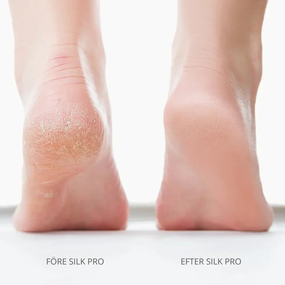 Electric Foot File for Soft Feet